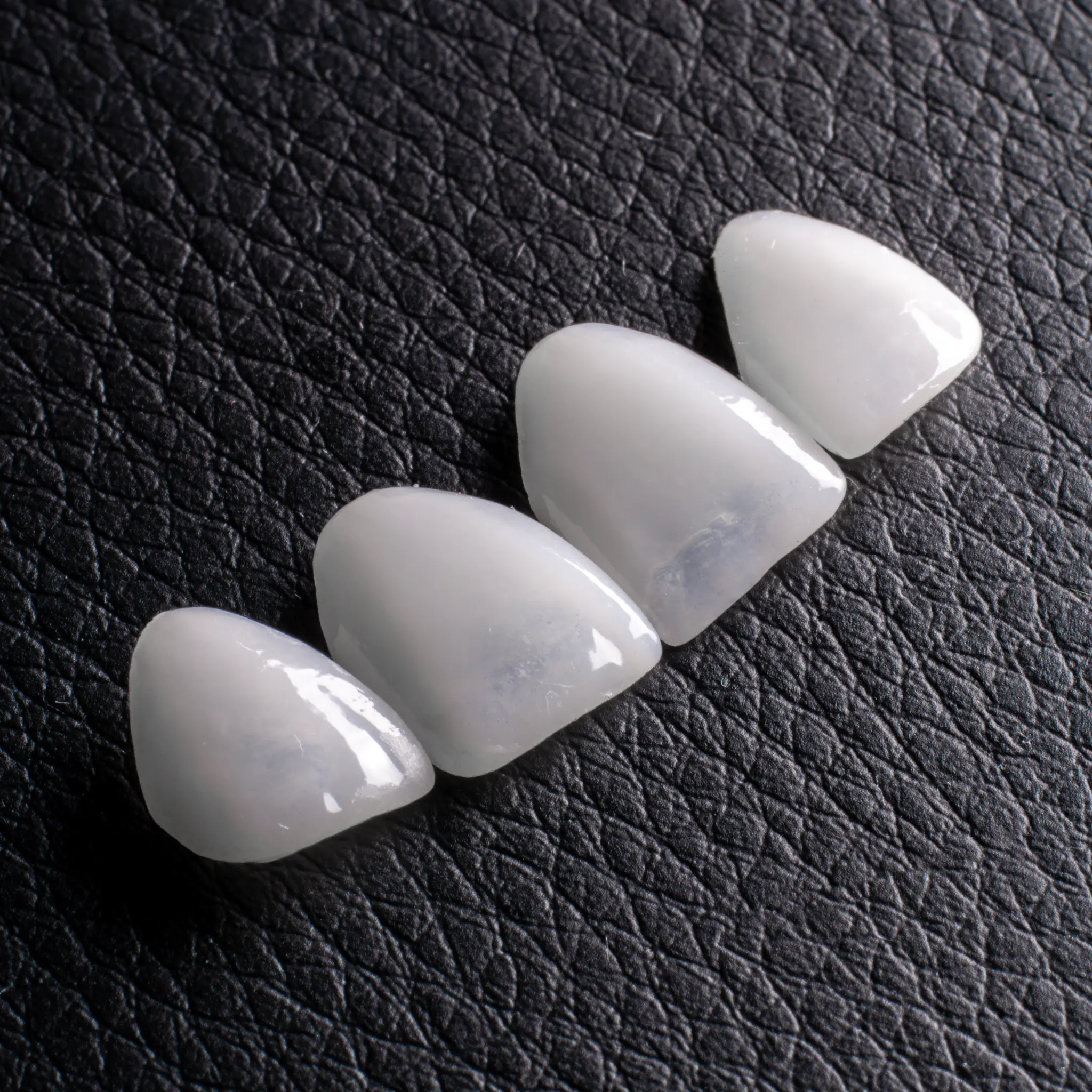 Monolithic restoration - full arch