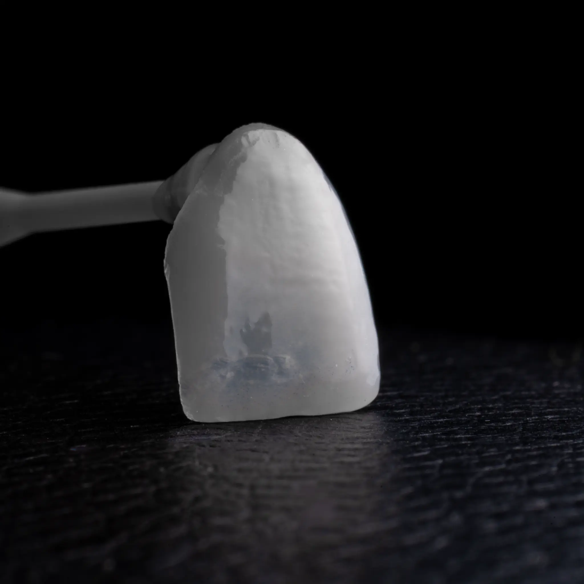 Monolithic restoration - anterior view