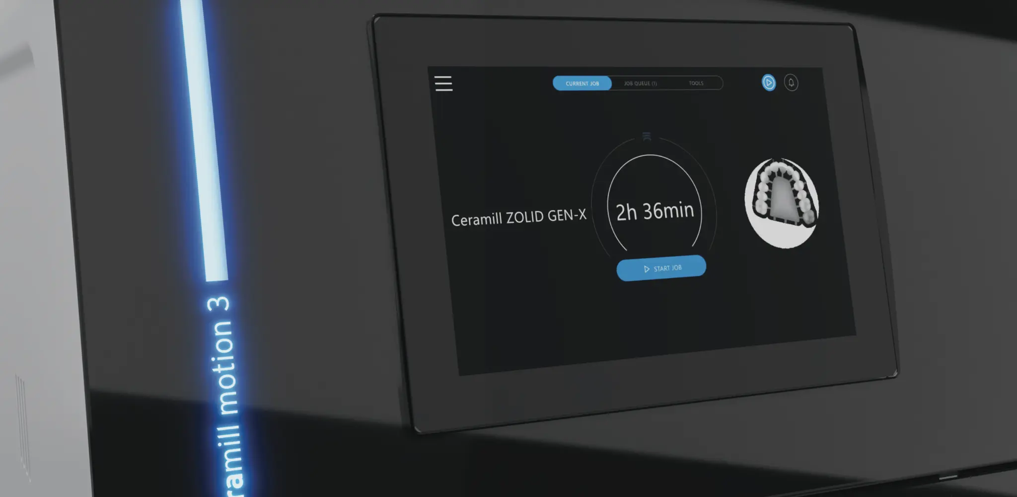 Ceramill Motion 3 Display